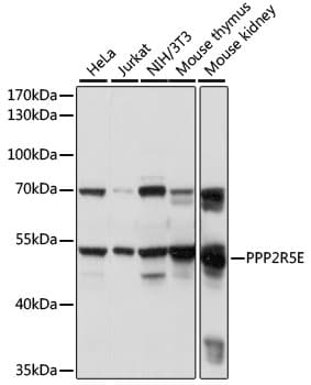 PPP2R5E Antibody