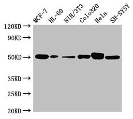 CALR / Calreticulin Antibody