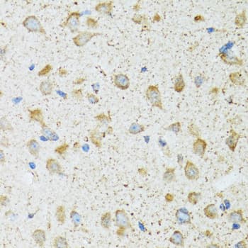 Polyclonal Rabbit anti-Human COG2 Antibody (IHC, WB)