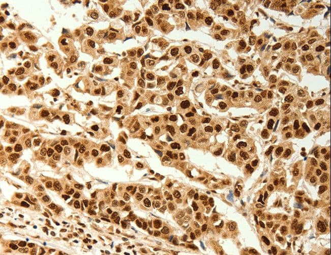 TIGAR Antibody
