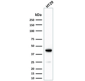 Monoclonal Mouse anti-Human KRT20 / CK20 / Cytokeratin 20 Antibody (clone KRT20/1992, IHC, WB)