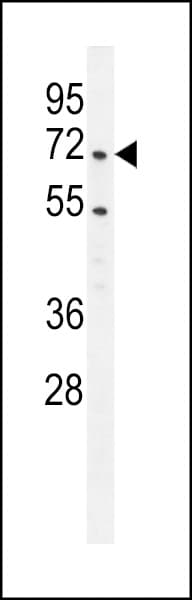 PRMT4 / CARM1 Antibody (aa346-377)
