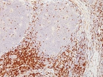 CD5 Antibody (clone CD5/54/F6)
