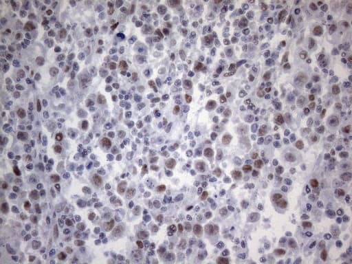 TP53BP1 / 53BP1 Antibody (aa1-300, clone OTI9C8)