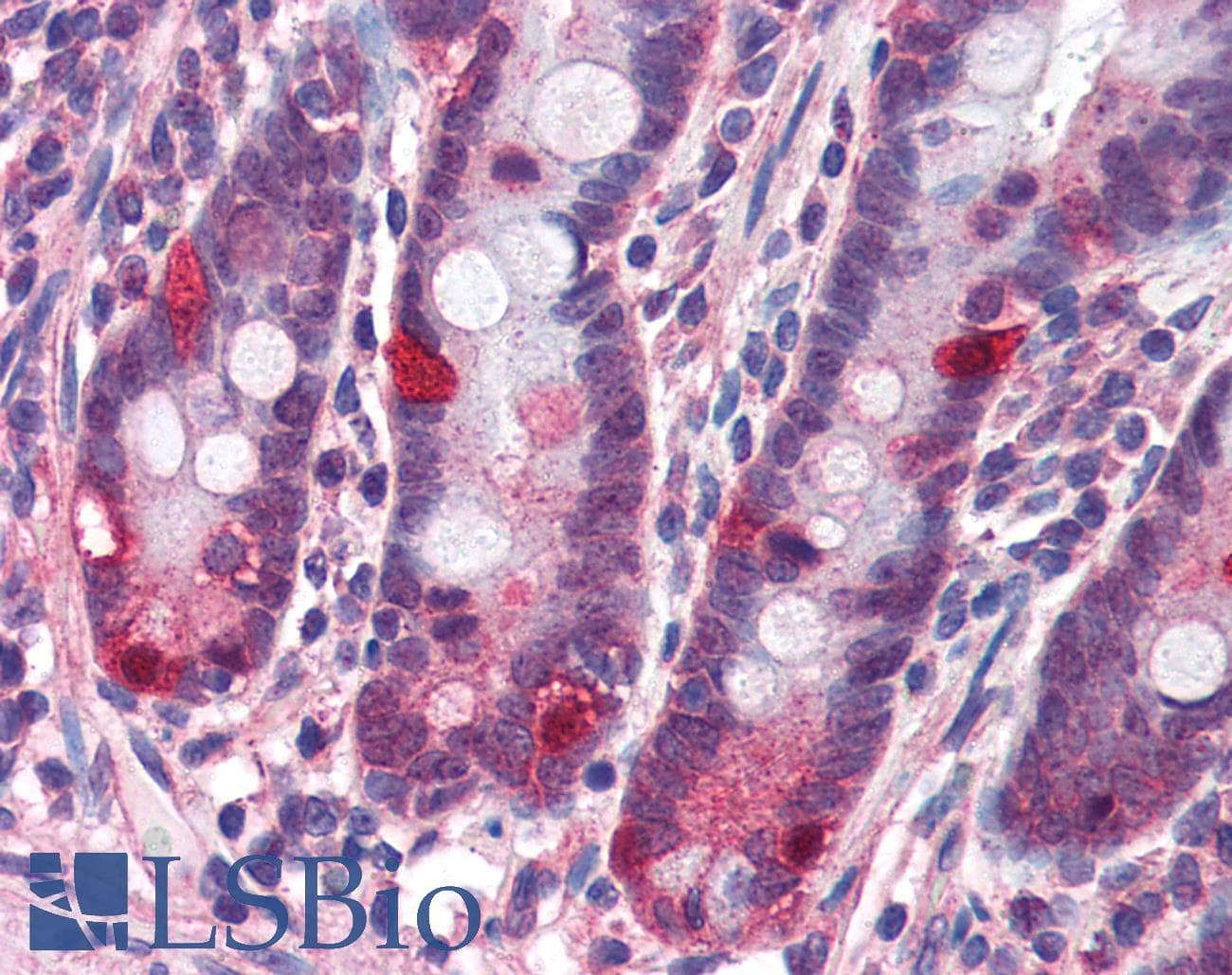 IHC-plus™ Polyclonal Rabbit anti-Human NOD2 / CARD15 Antibody (IHC, IF, WB)