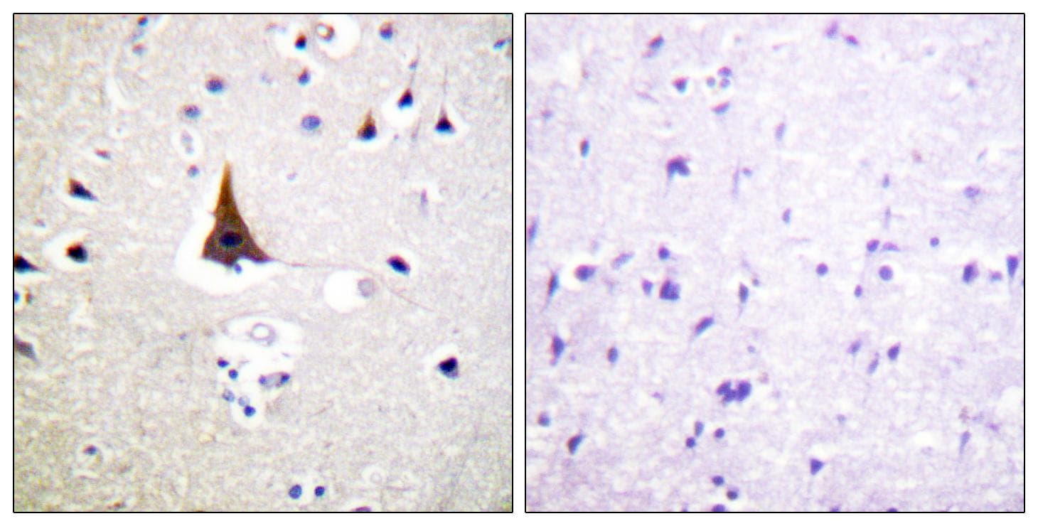Polyclonal Rabbit anti-Human VAV2 Antibody (p142, IHC, IF, WB)