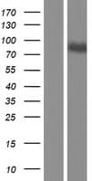 Human CAST / Calpastatin Protein (Over-Expression Lysate Myc-DDK (Flag))