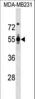 PODXL / Podocalyxin Antibody (aa410-439)