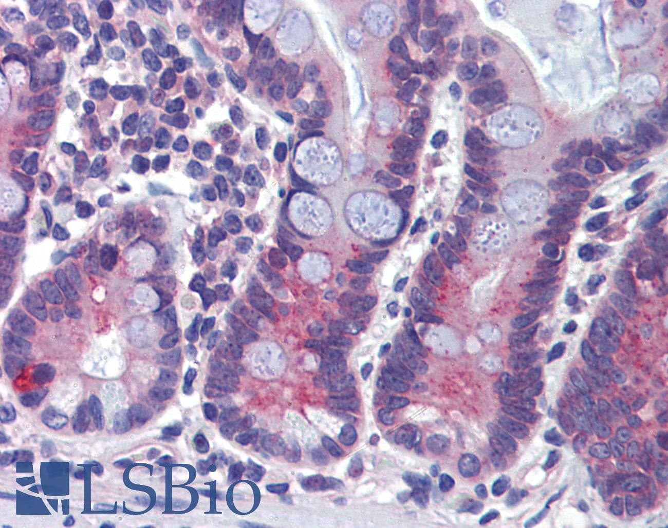 Polyclonal Rabbit anti-Human ABCA5 Antibody (aa1296-1345, IHC, WB)