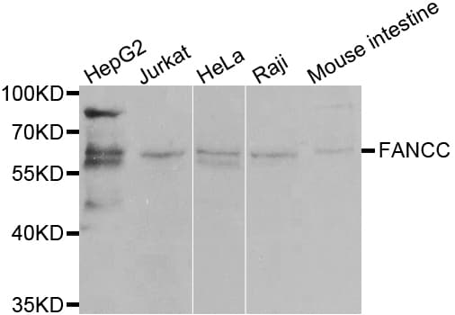 Polyclonal Rabbit anti-Human FANCC Antibody (IHC, IF, WB)