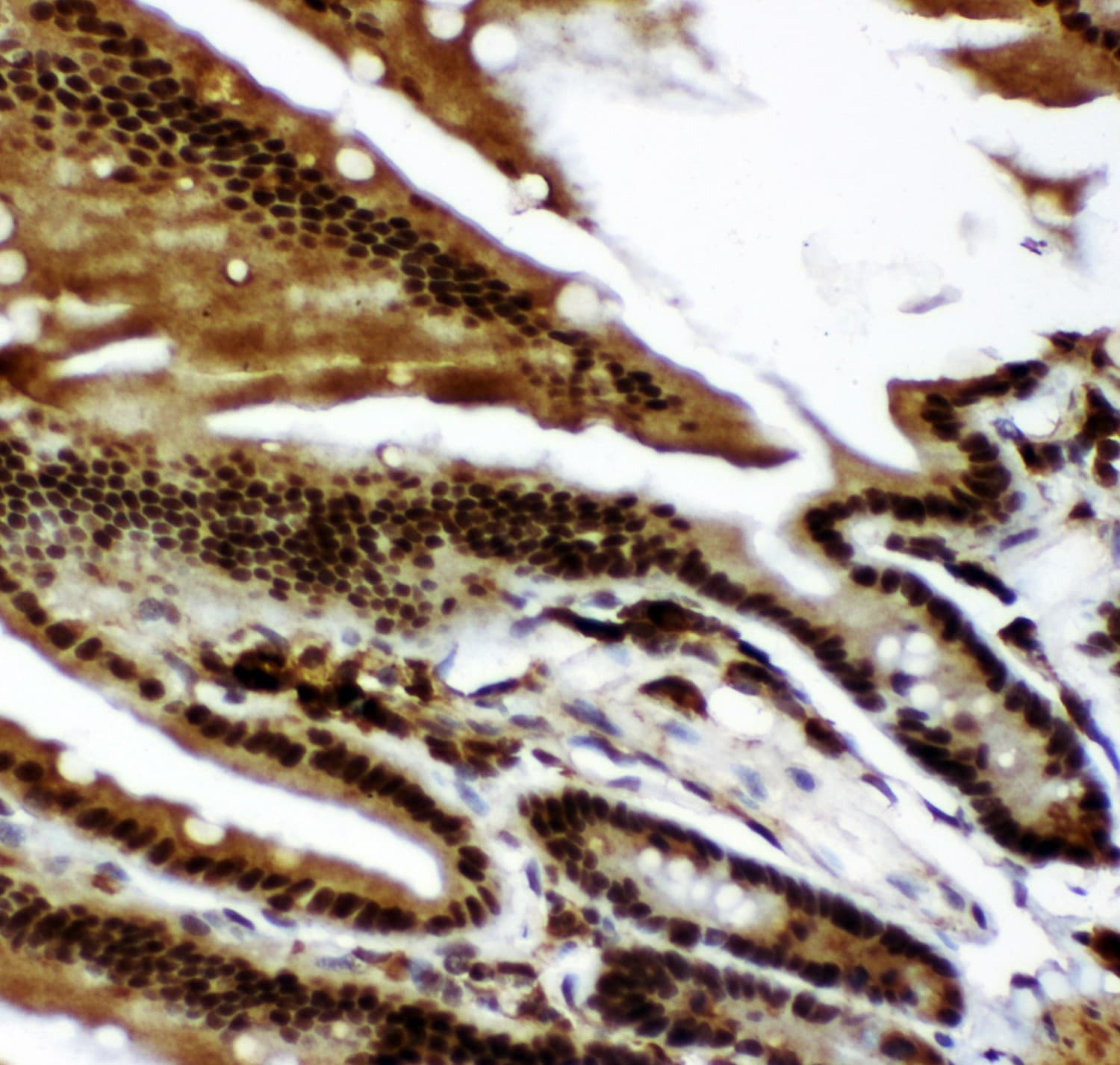 Polyclonal Rabbit anti-Human TP73 / p73 Antibody (aa1-198, IHC, WB)
