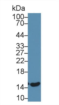 E-FABP / FABP5 Antibody (aa1-135, APC)