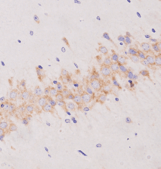 DCX / Doublecortin Antibody