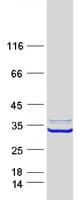 Human ABHD11 Protein (Recombinant Myc-DDK (Flag))