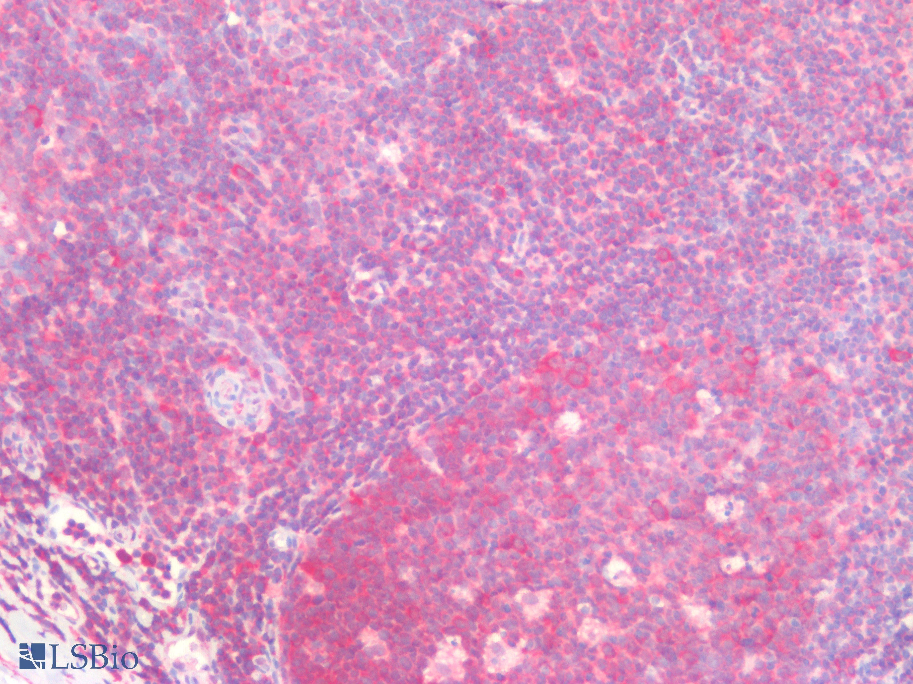 IHC-plus™ TCP1 Antibody (aa544-556)