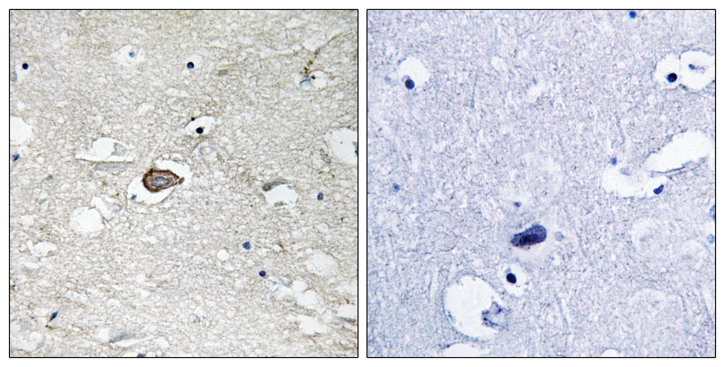 Polyclonal Rabbit anti-Human NTRK1 / TrkA Antibody (Ab-701, IHC, WB)