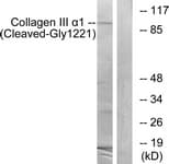 COL3A1 / Collagen III Antibody (aa1172-1221)