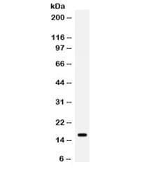 Polyclonal Rabbit anti-Human Gastric Inhibitory Peptide Antibody (IHC, WB)