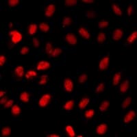 Polyclonal Rabbit anti-Human LHX8 Antibody (IF, WB)