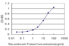 IHC-plus™ CES2 / Esterase Antibody (clone 4F12)
