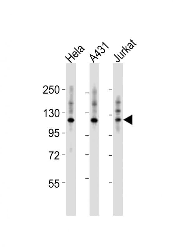 Polyclonal Rabbit anti-Human ITGA7 / Integrin Alpha 7 Antibody (aa247-279, WB)