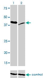 Monoclonal Mouse anti-Human RAD23A / HHR23A Antibody (clone 3C12, WB)