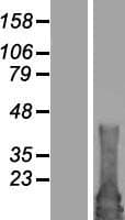 RAB4B Protein (Over-Expression Lysate Myc-DDK (Flag))