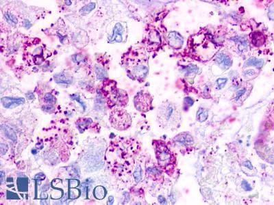 PathPlus™ TAAR2 / GPR58 Antibody (Cytoplasmic Domain)