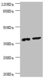 Polyclonal Rabbit anti-Human DEDD Antibody (IHC, WB)