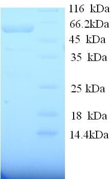 Rat ANGPT1 / Angiopoietin-1 Protein (Recombinant His)