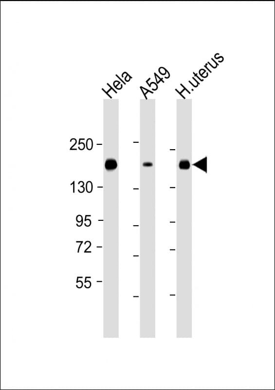 ITGA11 / Integrin Alpha 11 Antibody (clone 1804CT459.14.18)