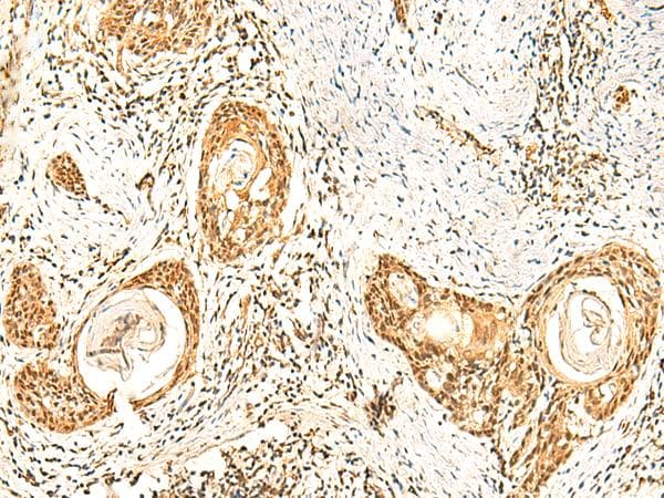 ZNF580 Antibody