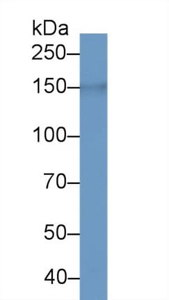 LIMCH1 Antibody (aa21-125, Biotin)