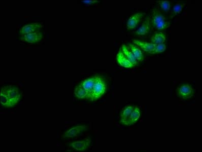 Polyclonal Rabbit anti-Human TRAF7 Antibody (IHC)