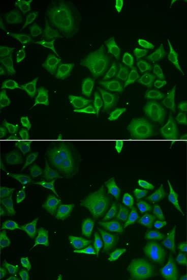 C1D Antibody