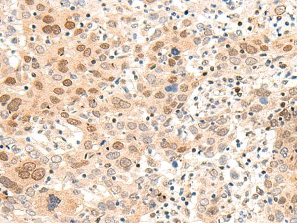 ARMC8 Antibody