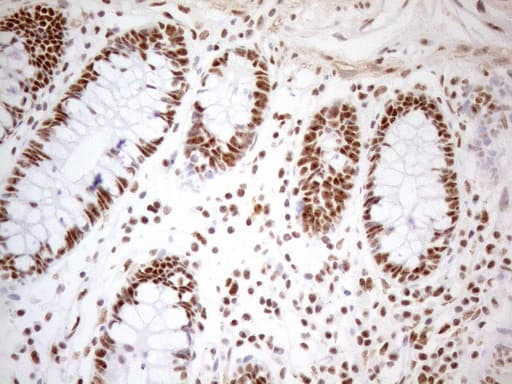 Monoclonal Mouse anti-Human WTAP Antibody (clone OTI12G7, aa2-106, IHC, WB)