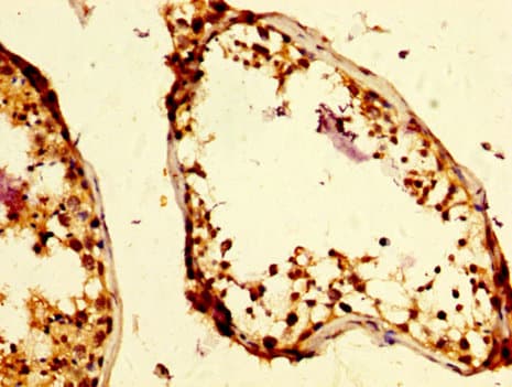Polyclonal Rabbit anti-Human UIMC1 / RAP80 Antibody (IHC, WB)