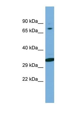 Polyclonal Rabbit anti-Human WIPF2 / WIRE Antibody (aa191-240, WB)