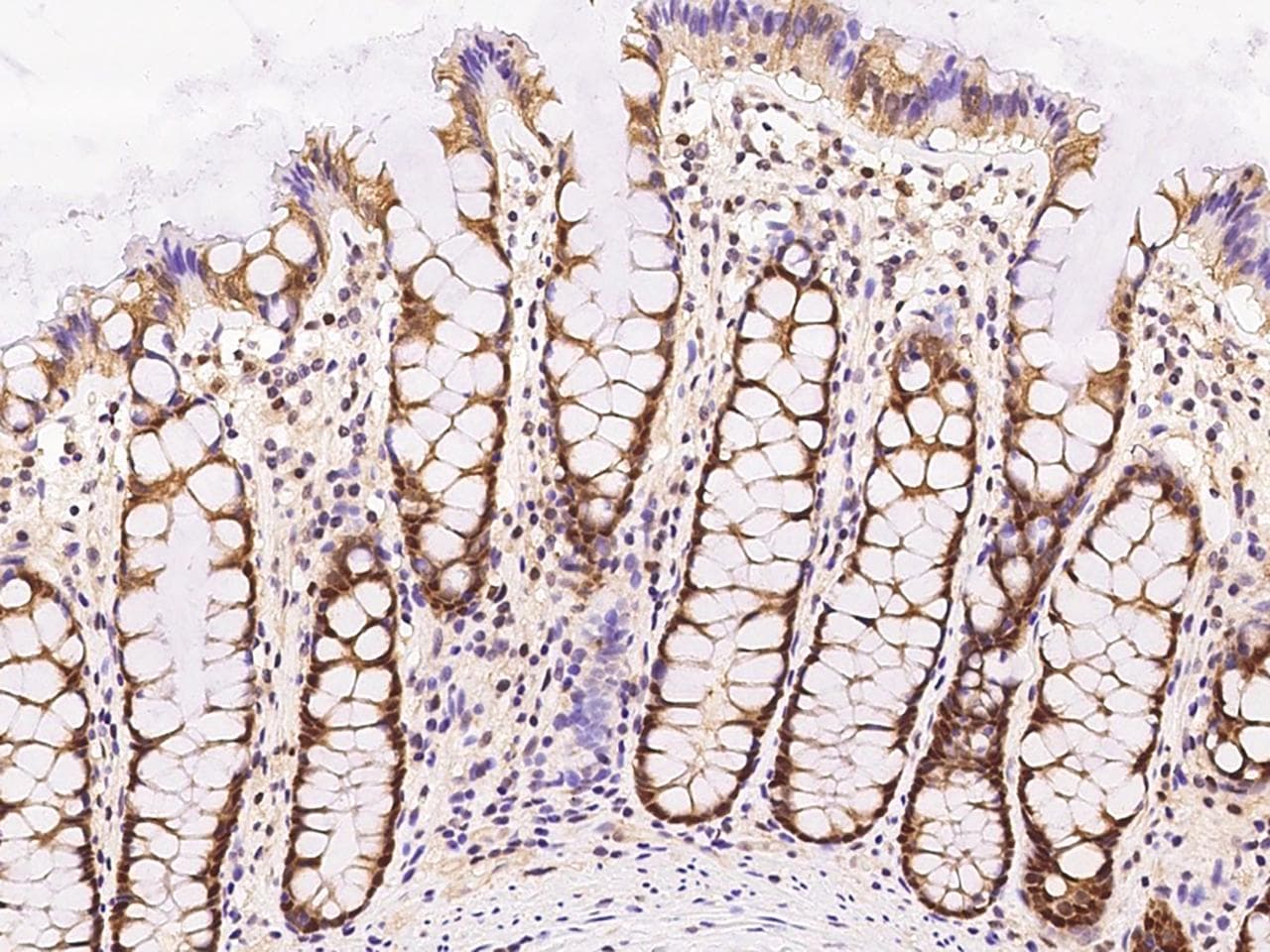 RMND5B Antibody