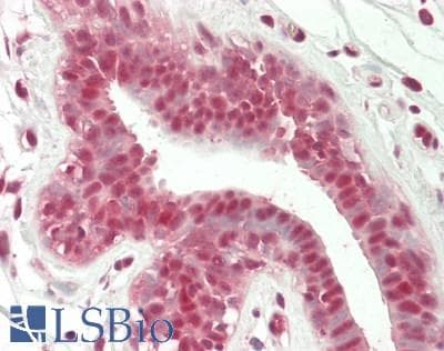 IHC-plus™ Polyclonal Rabbit anti-Human HNRNP-E2 / PCBP2 Antibody (IHC, IF, WB)