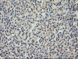SOLO / SESTD1 Antibody (clone OTI7G4)