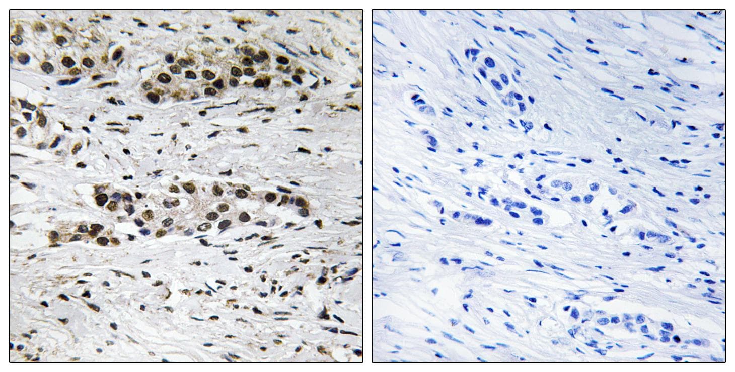 ER Alpha / Estrogen Receptor Antibody (phospho-Ser102)