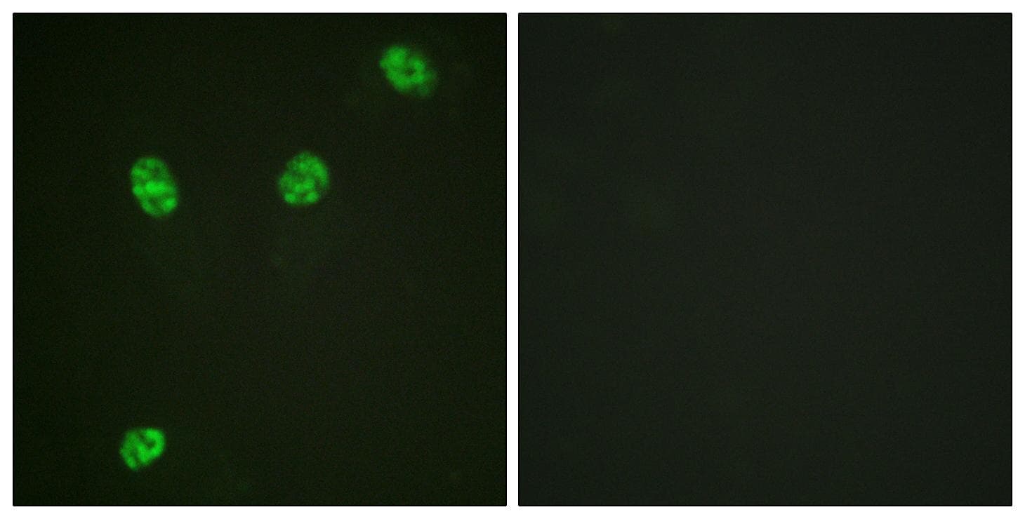 ERF / PE2 Antibody (phospho-Thr526)