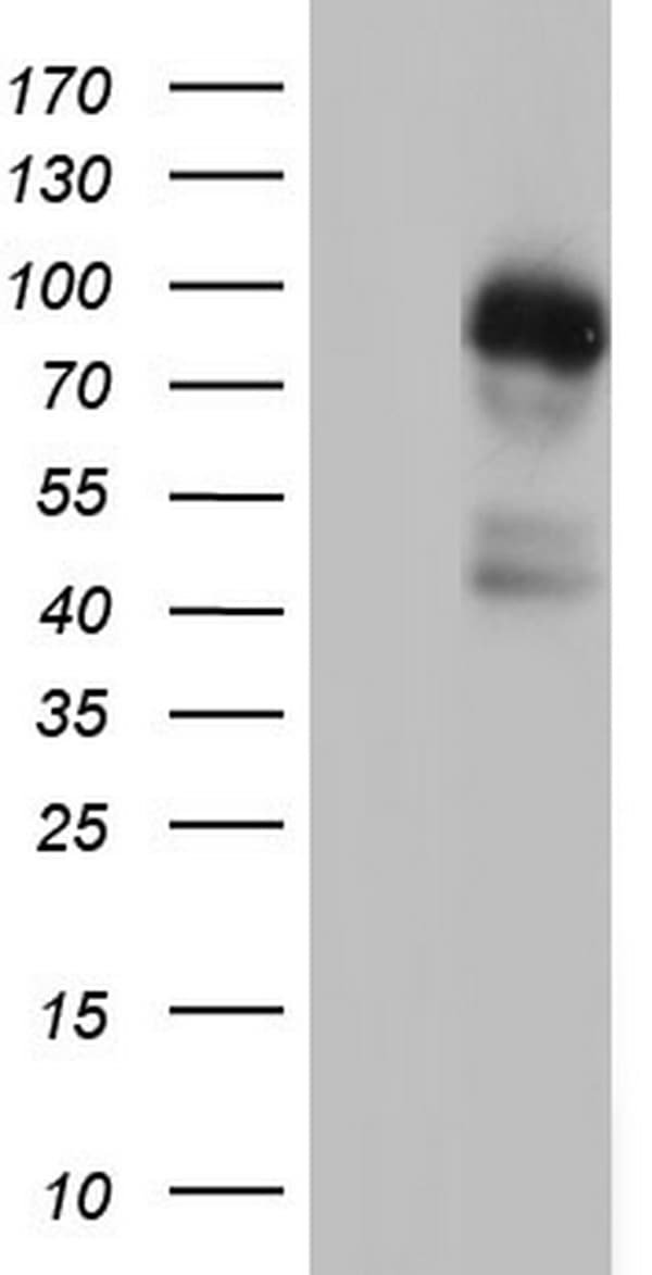 Monoclonal Mouse anti-Human MDM2 Antibody (clone OTI7F7, aa119-438, IHC, WB)