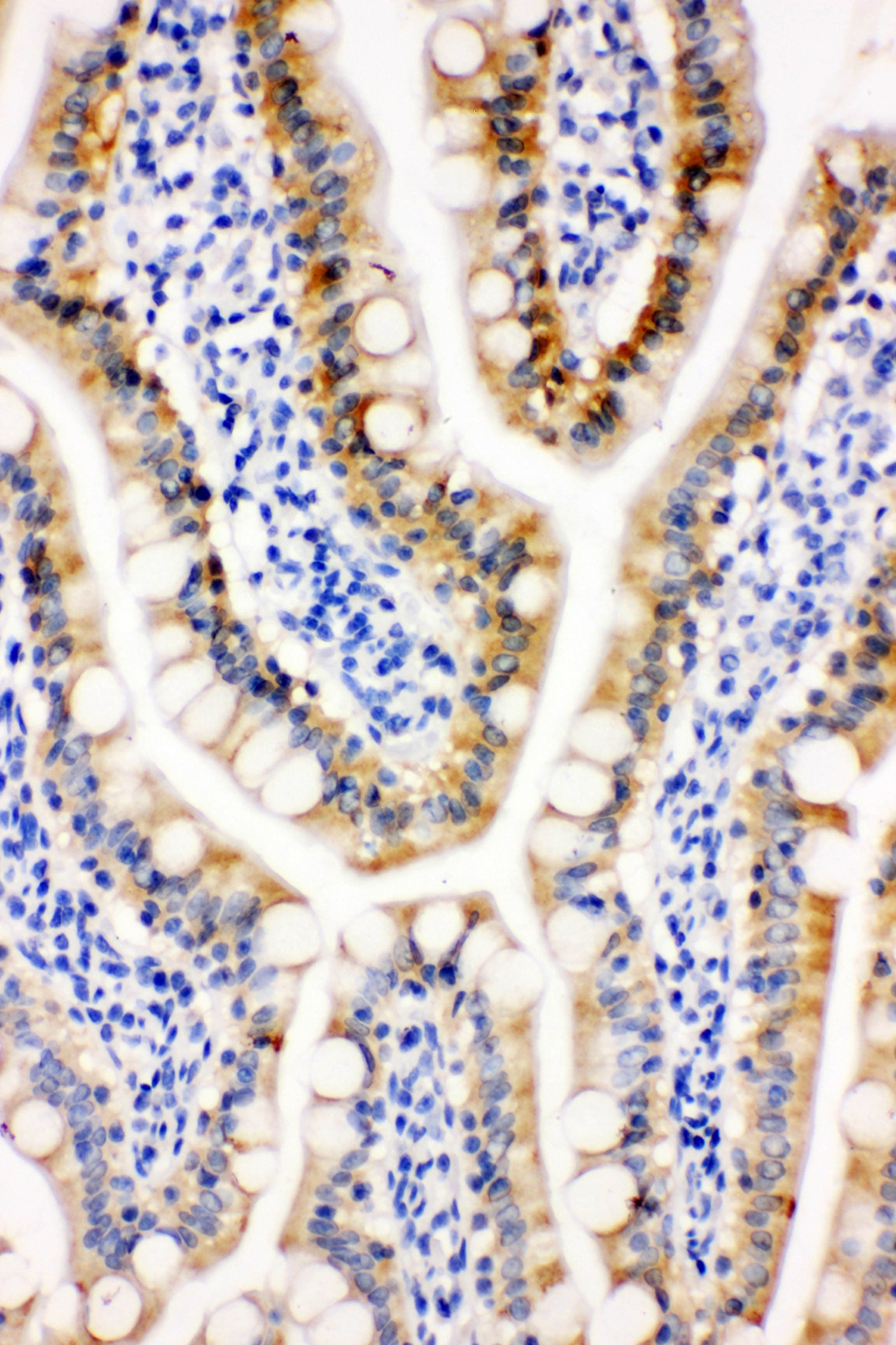 PRDX3 / Peroxiredoxin 3 Antibody (aa240-257)