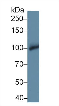 GPBB / PYGB Antibody (aa477-731)