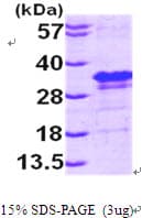 Human EIF4E Protein (Recombinant His)