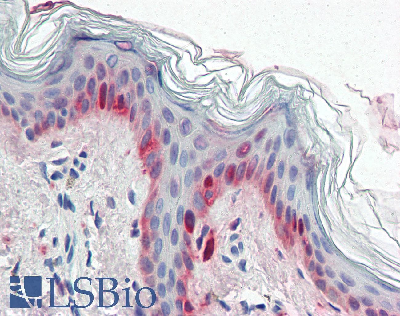 IHC-plus™ CRYAB / Alpha B Crystallin Antibody (clone 1D11C6E6)