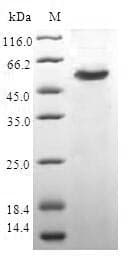 Human CAPZB / CAPZ Beta Protein (Recombinant GST, N-terminus)